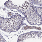 Anti-SLC6A2 Antibody