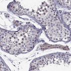 Immunohistochemical staining of human testis shows moderate nucleus positivity in cells in seminiferous ducts and cytoplasmic psoitivity in Leydig cells.