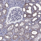Immunohistochemical staining of human kidney shows moderate membranous-cytoplasmic positivity in cells in tubules.
