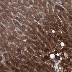 Immunohistochemical staining of human liver shows high expression.