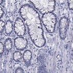 Immunohistochemical staining of human colon shows low expression as expected.