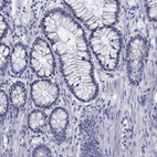 Immunohistochemical staining of human colon shows low expression as expected.