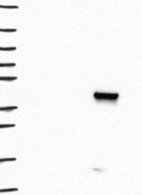 Lane 1: Marker [kDa] 250, 130, 95, 72, 55, 36, 28, 17, 10 | Lane 2: RT4 | Lane 3: U-251 MG | Lane 4: Human Plasma | Lane 5: Liver | Lane 6: Tonsil