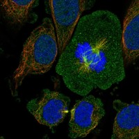 Anti-OTUD7B Antibody