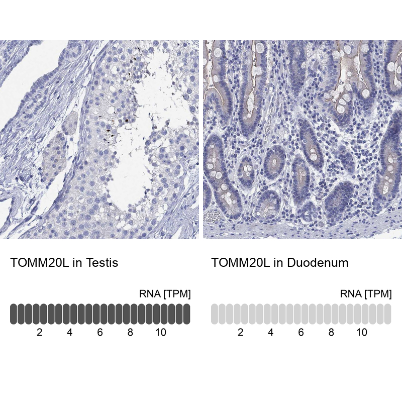 Anti-TOMM20L Antibody