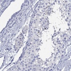 Immunohistochemical staining of human testis shows high expression.
