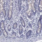 Immunohistochemical staining of human duodenum shows low expression as expected.