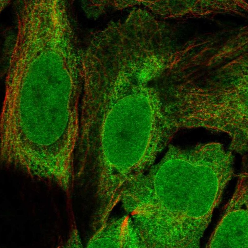 Anti-C11orf58 Antibody