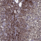 Anti-HDAC5 Antibody