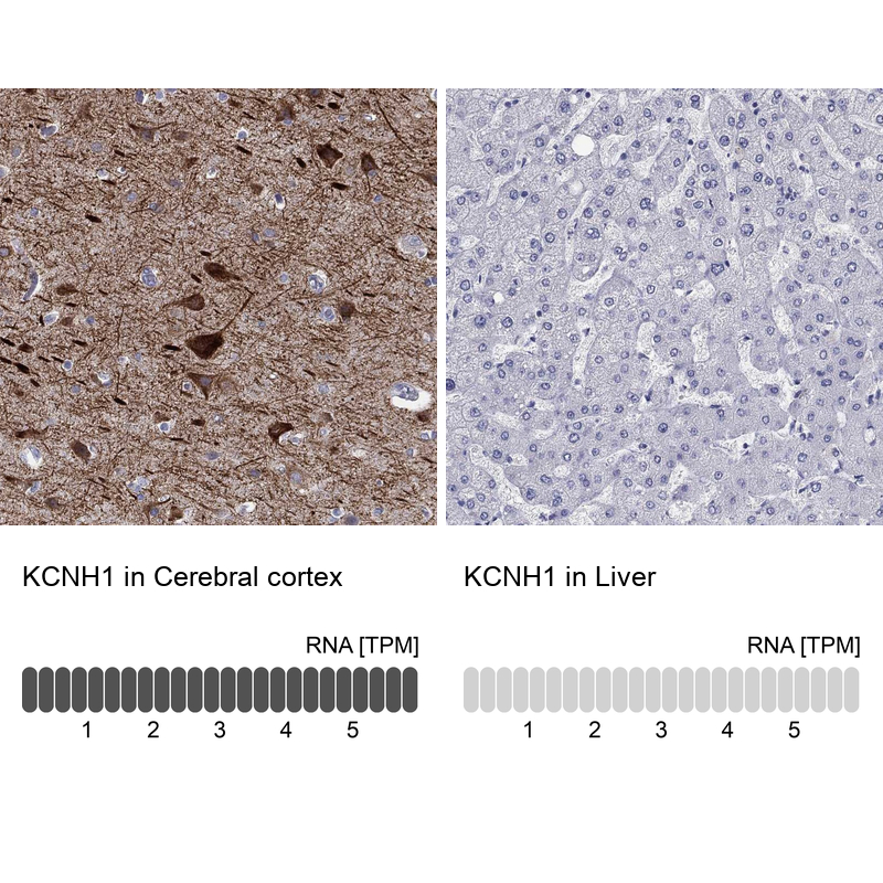 Anti-KCNH1 Antibody