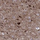 Immunohistochemical staining of human cerebral cortex shows high expression.