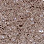 Immunohistochemical staining of human cerebral cortex shows high expression.