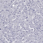 Immunohistochemical staining of human liver shows low expression as expected.