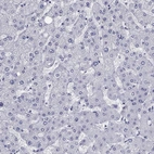 Immunohistochemical staining of human liver shows low expression as expected.