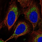 Anti-DEGS1 Antibody