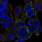 Immunofluorescent staining of human cell line Hep G2 shows localization to cytosol & vesicles.
