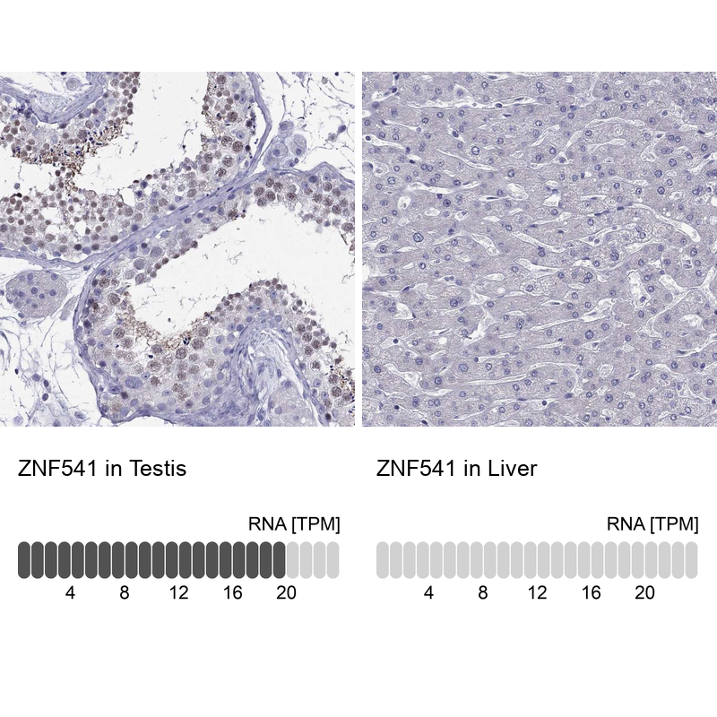 Anti-ZNF541 Antibody