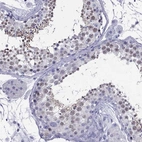 Immunohistochemical staining of human testis shows high expression.