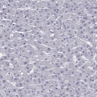 Anti-ZNF541 Antibody