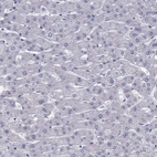 Immunohistochemical staining of human liver shows low expression as expected.