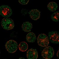 Anti-MAGEB16 Antibody