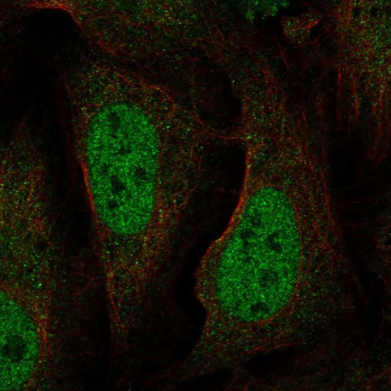 Anti-BRAT1 Antibody