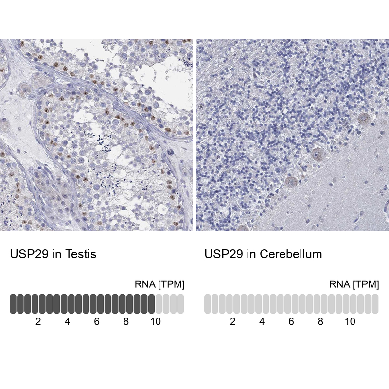 Anti-USP29 Antibody