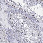 Immunohistochemical staining of human testis shows high expression.
