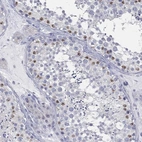 Immunohistochemical staining of human testis shows high expression.