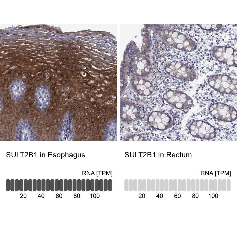Anti-SULT2B1 Antibody