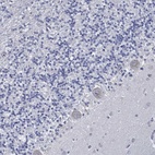 Immunohistochemical staining of human cerebellum shows low expression as expected.