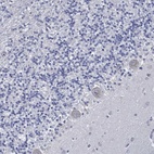 Anti-USP29 Antibody