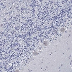 Immunohistochemical staining of human cerebellum shows low expression as expected.