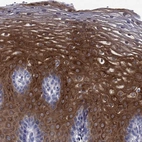 Immunohistochemical staining of human esophagus shows high expression.