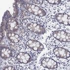 Immunohistochemical staining of human rectum shows low expression as expected.