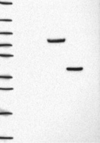 Lane 1: Marker [kDa] 250, 130, 95, 72, 55, 36, 28, 17, 10 | Lane 2: RT4 | Lane 3: U-251 MG | Lane 4: Human Plasma | Lane 5: Liver | Lane 6: Tonsil