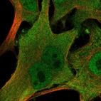 Immunofluorescent staining of human cell line SK-MEL-30 shows localization to nucleoplasm & cytosol.