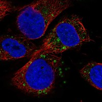 Anti-IQSEC2 Antibody
