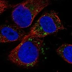 Anti-IQSEC2 Antibody