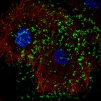 Anti-KLHDC7B Antibody
