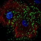 Anti-KLHDC7B Antibody