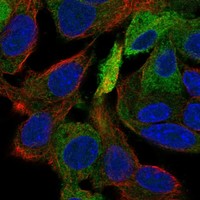 Anti-ERRFI1 Antibody