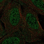 Anti-CSDC2 Antibody