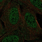 Anti-CSDC2 Antibody