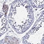 Immunohistochemical staining of human testis shows high expression.