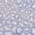 Immunohistochemical staining of human stomach shows low expression as expected.