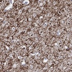 Anti-RIMS1 Antibody