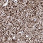 Anti-RIMS1 Antibody
