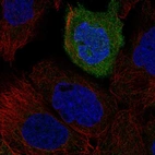 Anti-TACR2 Antibody