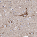 Anti-REEP2 Antibody
